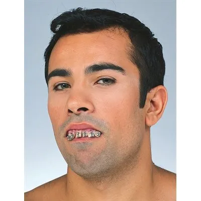 DIENTES CON APARATOS  2135